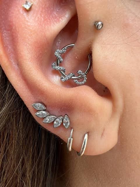 aretes